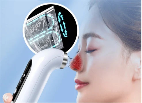 Vacuum Pore Cleaner